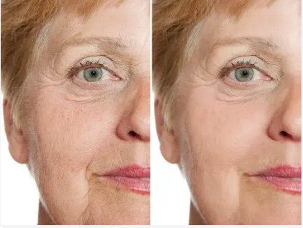 Natural Approaches to Anti-Aging - illustration