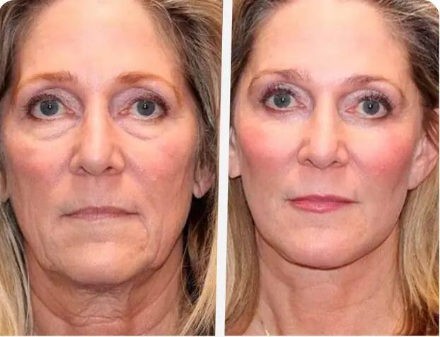 Luminara Rewind customer review Diane M Scottsdale Arizona