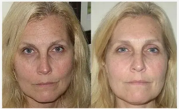 Luminara Rewind customer review Rachel S Minneapolis Minnesota